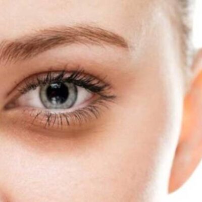 شش روش از بین بردن تیرگی زیر چشم